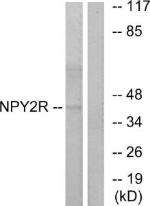 Western blot analysis of lysates from HepG2 cells using Anti-NPY2R Antibody. The right hand lane represents a negative control, where the Antibody is blocked by the immunising peptide