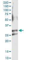 Anti-ARHGDIA Rabbit Polyclonal Antibody