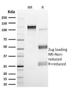 SDS-PAGE analysis of Anti-Calpain 1 Antibody [CAPN1/1530] under non-reduced and reduced conditions; showing intact IgG and intact heavy and light chains, respectively. SDS-PAGE analysis confirms the integrity and purity of the antibody.