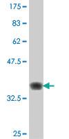 Anti-RNF20 Mouse Polyclonal Antibody