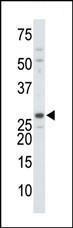 Anti-DTYMK Rabbit Polyclonal Antibody (APC (Allophycocyanin))