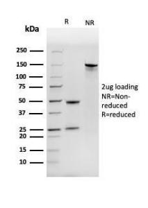 SDS-PAGE analysis of Anti-NME1 Antibody [NME1/2737] under non-reduced and reduced conditions; showing intact IgG and intact heavy and light chains, respectively. SDS-PAGE analysis confirms the integrity and purity of the antibody