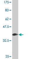 Anti-PLIN1 Mouse Monoclonal Antibody [clone: 4G1]