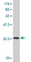 Anti-RCVRN Mouse Monoclonal Antibody [clone: 1B7]