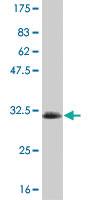 Anti-SGK2 Mouse Monoclonal Antibody [clone: 7C7]