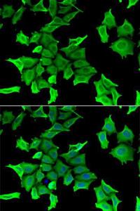 Anti-HGFA Inhibitor 2 antibody