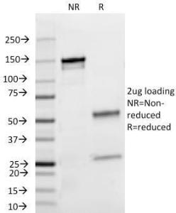 Anti-Lambda Light Chain Mouse Monoclonal Antibody [clone: HP6054]