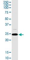 Anti-ARHGDIA Rabbit Polyclonal Antibody