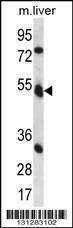 Anti-FKTN Rabbit Polyclonal Antibody (Biotin)