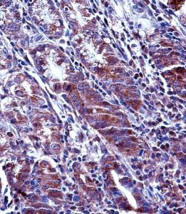 Anti-MCL1 Rabbit Polyclonal Antibody (AP (Alkaline Phosphatase))