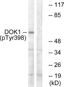 Western blot analysis of lysates from K562 cells treated with Starvation 24h using Anti-p62 Dok (phospho Tyr398) Antibody The right hand lane represents a negative control, where the antibody is blocked by the immunising peptide