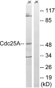 Western blot analysis of lysates from Jurkat cells using Anti-CDC25A Antibody. The right hand lane represents a negative control, where the antibody is blocked by the immunising peptide