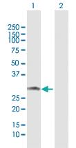 Anti-ARHGDIA Rabbit Polyclonal Antibody