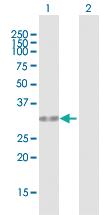 Anti-HUS1 Mouse Polyclonal Antibody