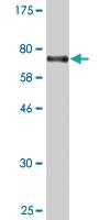 Anti-PUS1 Mouse Monoclonal Antibody [clone: 3A3]