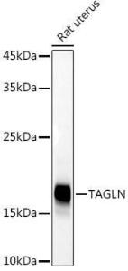 Western blot analysis of extracts of Rat uterus, using Anti-TAGLN/Transgelin Antibody (A9989) at 1:500 dilution