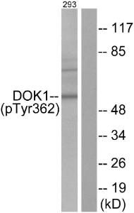 Western blot analysis of lysates from 293 cells using Anti-p62 Dok (phospho Tyr362) Antibody. The right hand lane represents a negative control, where the antibody is blocked by the immunising peptide