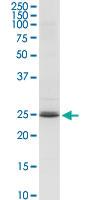 Anti-ARHGDIA Rabbit Polyclonal Antibody