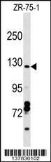 Anti-CCDC132 Rabbit Polyclonal Antibody (HRP (Horseradish Peroxidase))