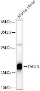 Western blot analysis of extracts of Mouse uterus, using Anti-TAGLN/Transgelin Antibody (A9989) at 1:500 dilution