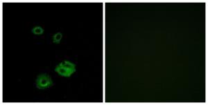 Immunofluorescence analysis of A549 cells using Anti-NPY2R Antibody. The right hand panel represents a negative control, where the Antibody was pre-incubated with the immunising peptide