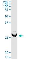 Anti-ARHGDIA Rabbit Polyclonal Antibody