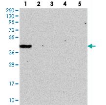 Anti-GIMAP1 Rabbit Polyclonal Antibody