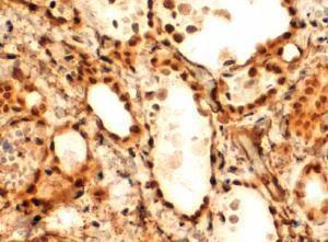 Anti-FOXE1 Antibody (A83943) (2µg/ml) staining of paraffin embedded Human Thyroid Gland. Steamed antigen retrieval with Tris/EDTA buffer pH 9, HRP-staining.