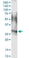 Anti-ARHGDIA Rabbit Polyclonal Antibody