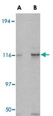 Anti-KIF5A Rabbit Polyclonal Antibody