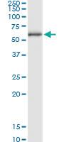 Anti-CCT8L2 Rabbit Polyclonal Antibody