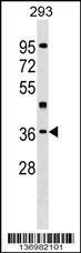 Anti-HLF Rabbit Polyclonal Antibody (AP (Alkaline Phosphatase))