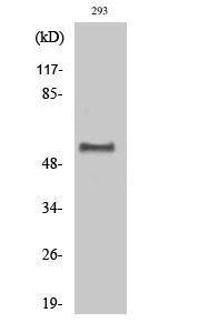 Western blot analysis of various cells using Anti-p62 Dok (phospho Tyr362) Antibody