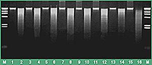 Genomic DNA purification kit, Fermentas