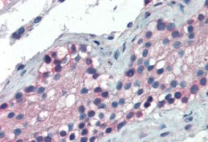 Anti-FOXE1 Antibody (A83943) (5µg/ml) staining of paraffin embedded Human Testis. Steamed antigen retrieval with Tris/EDTA buffer pH 9, AP-staining.