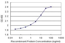 Anti-ODC Antibody Pair