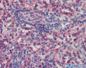 Anti-MKNK2 Rabbit Polyclonal Antibody