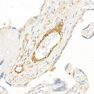 Immunohistochemistry analysis of paraffin-embedded human placenta using Anti-TAGLN/Transgelin Antibody (A9989) at a dilution of 1:20 (40X lens). Perform high pressure antigen retrieval with 10 mM citrate buffer pH 6.0 before commencing with IHC staining protocol