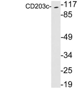 Western blot analysis of lysates from Jurkat cells using Anti-CD203c Antibody