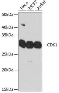 Western blot analysis of extracts of various cell lines, using Anti-CDK1 Antibody [ARC50607] (A305462) at 1:1,000 dilution. The secondary antibody was Goat Anti-Rabbit IgG H&L Antibody (HRP) at 1:10,000 dilution.