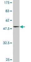 Anti-RCVRN Mouse Monoclonal Antibody [clone: 3F6]