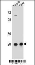 Anti-CCDC134 Rabbit Polyclonal Antibody (Biotin)