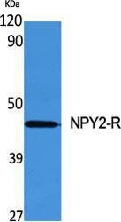 Western blot analysis of various cells using Anti-NPY2R Antibody