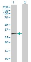 Anti-HUS1 Rabbit Polyclonal Antibody