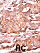 Anti-RAD9A Rabbit Polyclonal Antibody (Biotin)