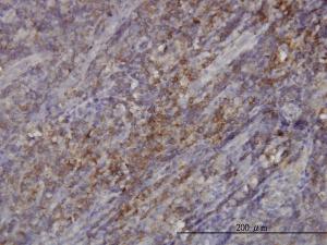 Anti-RASGRP4 Mouse Monoclonal Antibody [clone: 1F3]