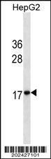 Anti-HMGA2 Mouse Monoclonal Antibody [clone: 523ct16.1.1]