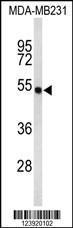 Anti-FLAD1 Rabbit Polyclonal Antibody (HRP (Horseradish Peroxidase))