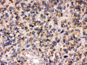 Anti-APBB1 Rabbit Polyclonal Antibody