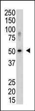 Anti-SENP5 Rabbit Polyclonal Antibody (AP (Alkaline Phosphatase))